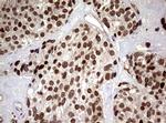 USP44 Antibody in Immunohistochemistry (Paraffin) (IHC (P))