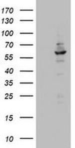 DDX56 Antibody in Western Blot (WB)