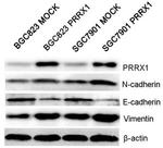 PRRX1 Antibody in Western Blot (WB)