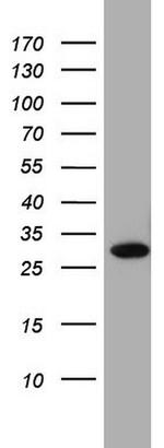 RTRAF Antibody in Western Blot (WB)