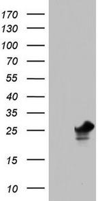 PAFAH1B3 Antibody in Western Blot (WB)