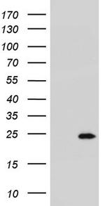 RSPO1 Antibody in Western Blot (WB)