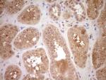 SAV1 Antibody in Immunohistochemistry (Paraffin) (IHC (P))