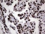 hnRNP L Antibody in Immunohistochemistry (Paraffin) (IHC (P))