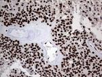 hnRNP L Antibody in Immunohistochemistry (Paraffin) (IHC (P))