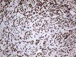 hnRNP L Antibody in Immunohistochemistry (Paraffin) (IHC (P))