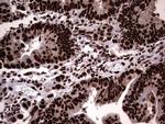 hnRNP L Antibody in Immunohistochemistry (Paraffin) (IHC (P))