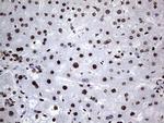 hnRNP L Antibody in Immunohistochemistry (Paraffin) (IHC (P))