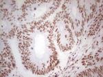 ABH1 Antibody in Immunohistochemistry (Paraffin) (IHC (P))