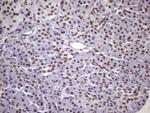 NUDT21 Antibody in Immunohistochemistry (Paraffin) (IHC (P))