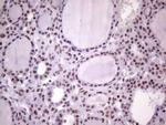 NUDT21 Antibody in Immunohistochemistry (Paraffin) (IHC (P))