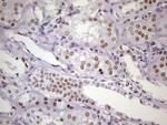 NUDT21 Antibody in Immunohistochemistry (Paraffin) (IHC (P))