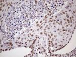 NUDT21 Antibody in Immunohistochemistry (Paraffin) (IHC (P))