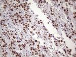 NUDT21 Antibody in Immunohistochemistry (Paraffin) (IHC (P))