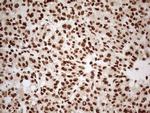 ALOX5 Antibody in Immunohistochemistry (Paraffin) (IHC (P))