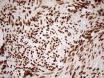 ALOX5 Antibody in Immunohistochemistry (Paraffin) (IHC (P))