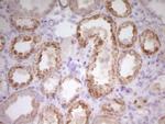 PAPSS2 Antibody in Immunohistochemistry (Paraffin) (IHC (P))