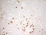 Myeloid Specific Antigen Antibody in Immunohistochemistry (Paraffin) (IHC (P))