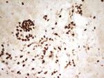 Myeloid Specific Antigen Antibody in Immunohistochemistry (Paraffin) (IHC (P))