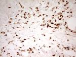 Myeloid Specific Antigen Antibody in Immunohistochemistry (Paraffin) (IHC (P))