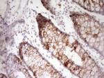 VEGFD Antibody in Immunohistochemistry (Paraffin) (IHC (P))