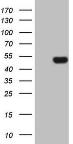 VEGFD Antibody in Western Blot (WB)