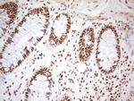 WTAP Antibody in Immunohistochemistry (Paraffin) (IHC (P))