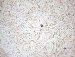 WTAP Antibody in Immunohistochemistry (Paraffin) (IHC (P))