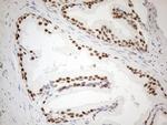 WTAP Antibody in Immunohistochemistry (Paraffin) (IHC (P))