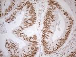 WTAP Antibody in Immunohistochemistry (Paraffin) (IHC (P))