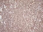 WTAP Antibody in Immunohistochemistry (Paraffin) (IHC (P))