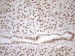 WTAP Antibody in Immunohistochemistry (Paraffin) (IHC (P))