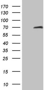 HABP2 Antibody in Western Blot (WB)