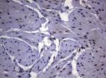 SF1 Antibody in Immunohistochemistry (Paraffin) (IHC (P))