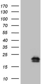 ANP Antibody in Western Blot (WB)