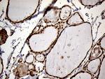 MEIS1 Antibody in Immunohistochemistry (Paraffin) (IHC (P))