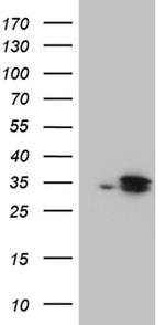 DHRS4L2 Antibody in Western Blot (WB)