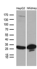 DHRS4L2 Antibody in Western Blot (WB)