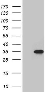 SERPINB8 Antibody in Western Blot (WB)