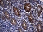 TIMM23 Antibody in Immunohistochemistry (Paraffin) (IHC (P))