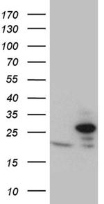 TIMM23 Antibody in Western Blot (WB)