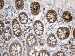 ACADM Antibody in Immunohistochemistry (Paraffin) (IHC (P))