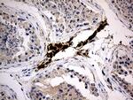 MGARP Antibody in Immunohistochemistry (Paraffin) (IHC (P))