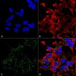 VGLUT3 Antibody in Immunocytochemistry (ICC/IF)