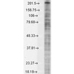 SCN10A Antibody in Western Blot (WB)