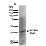 Kir6.1 (KCNJ8) Antibody in Western Blot (WB)