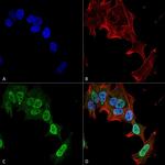 mGluR5 Antibody in Immunocytochemistry (ICC/IF)