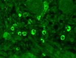 GABRA1 Antibody in Immunohistochemistry (Paraffin) (IHC (P))