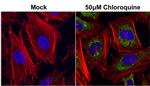 SQSTM1 Antibody in Immunocytochemistry (ICC/IF)