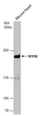 MYH6 Antibody in Western Blot (WB)